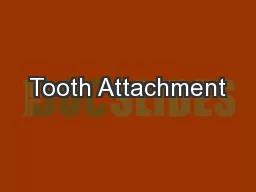 Tooth Attachment