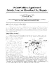 Patient Guide to Superior and AnteriorSuperior Migrati