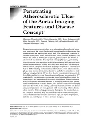 SCIENTIFIC EXHIBIT Penetrating Atherosclerotic Ulcer