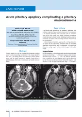 C  CASE REPORT Acute pituitary apoplexy complicat