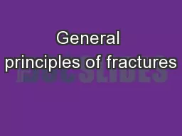 General principles of fractures