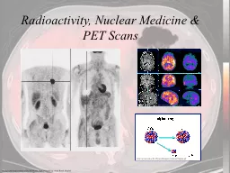 Radioactivity, Nuclear Medicine & PET Scans