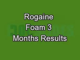 Rogaine Foam 3 Months Results