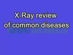X-Ray review of common diseases