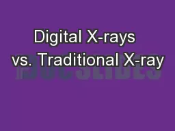 Digital X-rays vs. Traditional X-ray