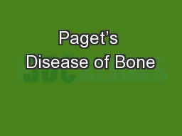 Paget’s Disease of Bone