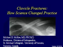 Clavicle Fractures: