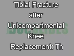 Tibial Fracture after Unicompartmental Knee Replacement: Th