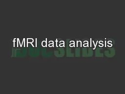fMRI data analysis