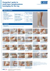 Comprilan guide to multilayer Lymphoedema bandaging fo