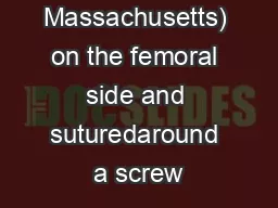 Andover, Massachusetts) on the femoral side and suturedaround a screw