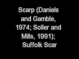 Scarp (Daniels and Gamble, 1974; Soller and Mills, 1991); Suffolk Scar