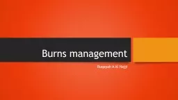Burns management