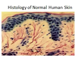 Histology of Normal Human Skin