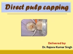Direct pulp capping