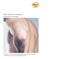 Boils and Skin Infections Information for the public T