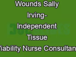 Managing Wounds Sally Irving- Independent Tissue Viability Nurse Consultant.