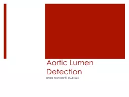 Aortic Lumen Detection Brad Wendorff, ECE 539