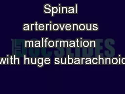 Spinal arteriovenous malformation with huge subarachnoid