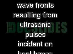 Imaging of propagating wave fronts resulting from ultrasonic pulses incident on heel bones