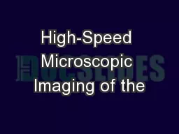 High-Speed Microscopic Imaging of the