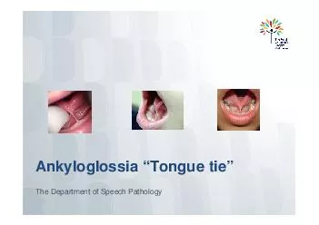 Ankyloglossia Tongue tie The Department of Speech Pathology What is ankyloglossia tongue