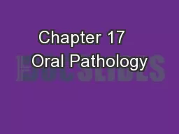 Chapter 17   Oral Pathology