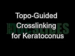 Topo-Guided Crosslinking for Keratoconus