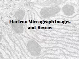 Electron Micrograph Images and Review