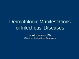 Dermatologic Manifestations of Infectious Diseases