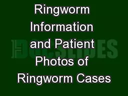 Ringworm Information and Patient Photos of Ringworm Cases