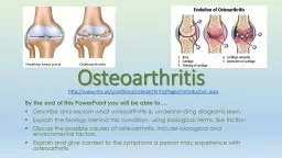 Osteoarthritis  By the end of this PowerPoint you will be able to….