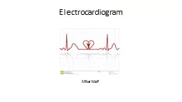 Mike Wolf    Electrocardiogram