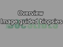 Overview Image guided biopsies