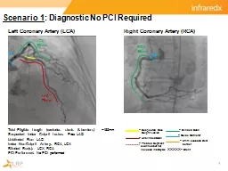Scenario 1 : Diagnostic No PCI Required
