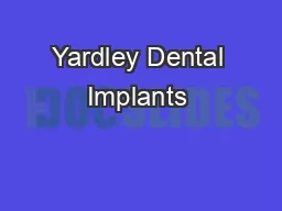 Yardley Dental Implants 