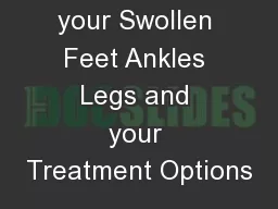Causes of your Swollen Feet Ankles Legs and your Treatment Options