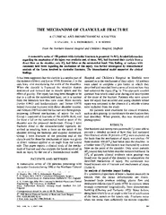 THE MECHANISM OF CLAVICULAR FRACTURE CLINICAL AND BIOM