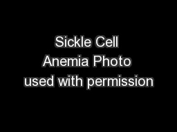 Sickle Cell Anemia Photo used with permission
