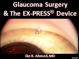 Glaucoma Surgery & The EX-PRESS