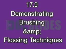 17.9 Demonstrating Brushing & Flossing Techniques