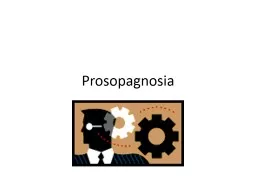 Prosopagnosia Visual  agnosias
