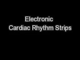 Electronic Cardiac Rhythm Strips