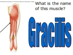 What is the  name  of this muscle?