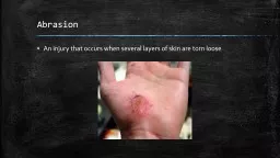 Abrasion		 An injury that occurs when several layers of skin are torn loose