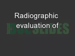 Radiographic evaluation of