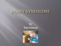 Down syndrome By  Erik Peterson