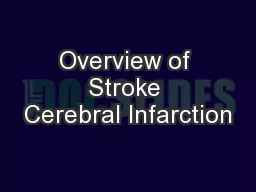 Overview of Stroke Cerebral Infarction