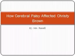 By: Mrs. Russell How Cerebral Palsy Affected Christy Brown