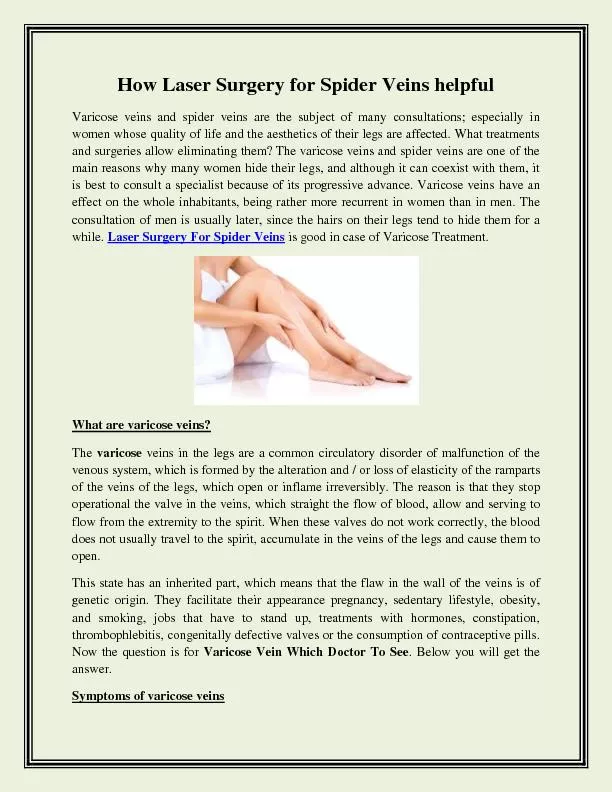 Laser Surgery for Spider Veins